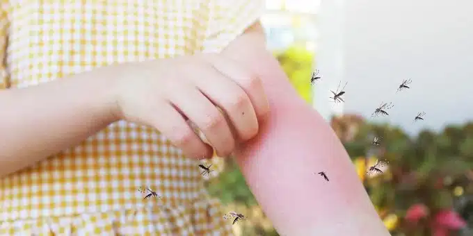 szúnyog raj egy gyerek kézen
